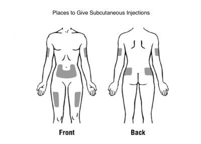 subcutaneous injection sites for injections